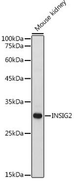 INSIG2 Antibody in Western Blot (WB)