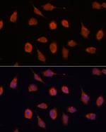 KCNAB2 Antibody in Immunocytochemistry (ICC/IF)