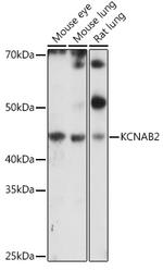 KCNAB2 Antibody in Western Blot (WB)