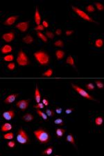 MCAK Antibody in Immunocytochemistry (ICC/IF)