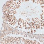 MCAK Antibody in Immunohistochemistry (Paraffin) (IHC (P))