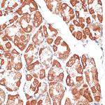 MCAK Antibody in Immunohistochemistry (Paraffin) (IHC (P))