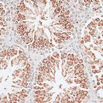 MCAK Antibody in Immunohistochemistry (Paraffin) (IHC (P))