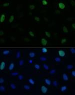 KIFC1 Antibody in Immunocytochemistry (ICC/IF)