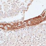 KIFC1 Antibody in Immunohistochemistry (Paraffin) (IHC (P))