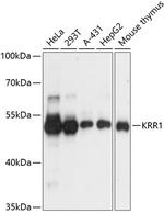 KRR1 Antibody in Western Blot (WB)