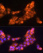 LAMC2 Antibody in Immunocytochemistry (ICC/IF)