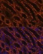 LAMC2 Antibody in Immunohistochemistry (Paraffin) (IHC (P))