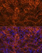 LAMC2 Antibody in Immunohistochemistry (Paraffin) (IHC (P))