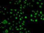 LDLRAP1 Antibody in Immunocytochemistry (ICC/IF)