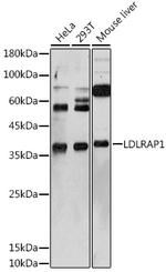 LDLRAP1 Antibody in Western Blot (WB)