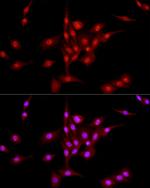 LIG3 Antibody in Immunocytochemistry (ICC/IF)