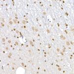 LIG3 Antibody in Immunohistochemistry (Paraffin) (IHC (P))