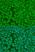 LLGL2 Antibody in Immunocytochemistry (ICC/IF)