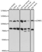 LONP2 Antibody in Western Blot (WB)