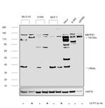 MBTPS1 Antibody in Western Blot (WB)