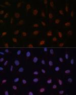 MED25 Antibody in Immunocytochemistry (ICC/IF)