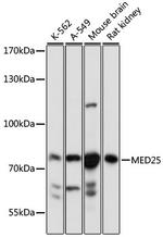 MED25 Antibody in Western Blot (WB)