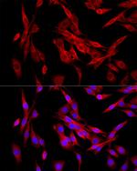 MEIS1 Antibody in Immunocytochemistry (ICC/IF)