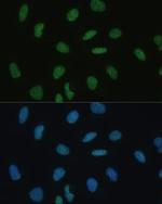 MKL1 Antibody in Immunocytochemistry (ICC/IF)