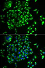 MRPL28 Antibody in Immunocytochemistry (ICC/IF)