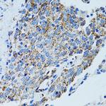 MRPL28 Antibody in Immunohistochemistry (Paraffin) (IHC (P))