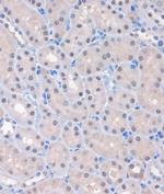 MTMR8 Antibody in Immunohistochemistry (Paraffin) (IHC (P))