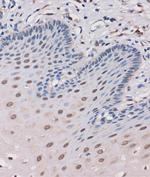 MTMR8 Antibody in Immunohistochemistry (Paraffin) (IHC (P))