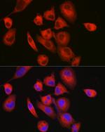 MYH7 Antibody in Immunocytochemistry (ICC/IF)