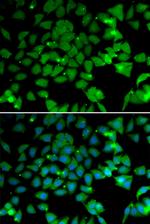 ARD1A Antibody in Immunocytochemistry (ICC/IF)