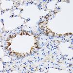 ARD1A Antibody in Immunohistochemistry (Paraffin) (IHC (P))