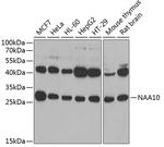 ARD1A Antibody in Western Blot (WB)