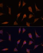 NCAPD2 Antibody in Immunocytochemistry (ICC/IF)