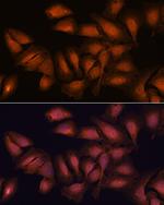 NCAPD2 Antibody in Immunocytochemistry (ICC/IF)