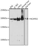 NCAPD2 Antibody in Western Blot (WB)