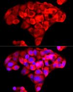 NNMT Antibody in Immunocytochemistry (ICC/IF)