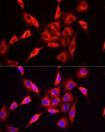 NNMT Antibody in Immunocytochemistry (ICC/IF)