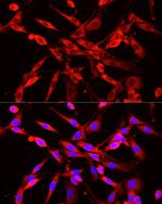 NNMT Antibody in Immunocytochemistry (ICC/IF)