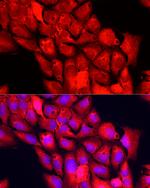 NNMT Antibody in Immunocytochemistry (ICC/IF)