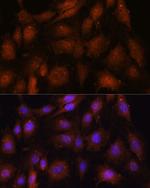 NOB1 Antibody in Immunocytochemistry (ICC/IF)