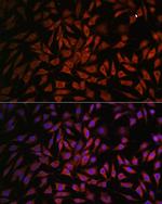 NOB1 Antibody in Immunocytochemistry (ICC/IF)