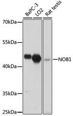 NOB1 Antibody in Western Blot (WB)