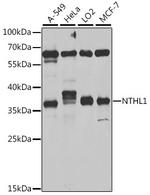 NTHL1 Antibody in Western Blot (WB)