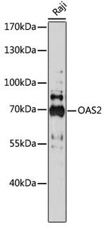 OAS2 Antibody in Western Blot (WB)