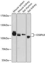 ORP8 Antibody in Western Blot (WB)