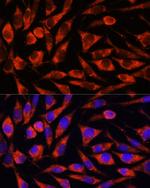 OTUD7B Antibody in Immunocytochemistry (ICC/IF)