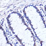 OTUD7B Antibody in Immunohistochemistry (Paraffin) (IHC (P))