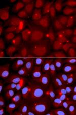 PADI4 Antibody in Immunocytochemistry (ICC/IF)