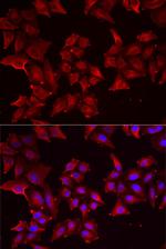 PCBD1 Antibody in Immunocytochemistry (ICC/IF)