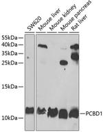 PCBD1 Antibody in Western Blot (WB)